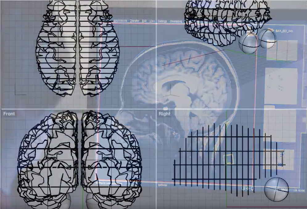 The Brains@MIT team recreated a scientifically accurate brain for the MIT2016 celebration.