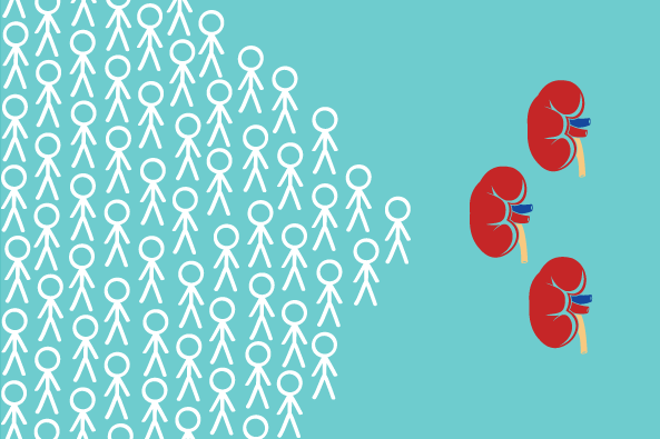 In the U.S., around 16,000 kidney transplants are performed each year. Art: Mimi Phan
