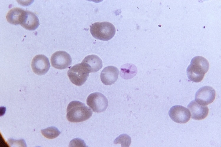 Microscopic image of the malaria parasite.