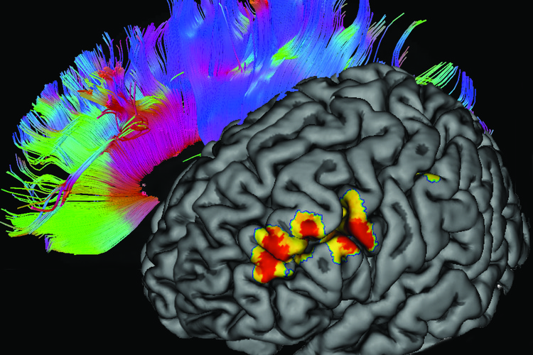 A black-and-gray figure of a brain in the foreground, with one small region lit up in yellow and red, with a colorful feather-like shape superimposed behind.