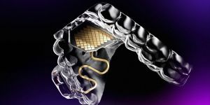 Illustration shows a clear mouthpiece on a purple background with a square gold sensor pad on its palate.